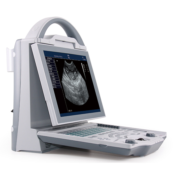 PT5600 Portable Ultrasound Scanner